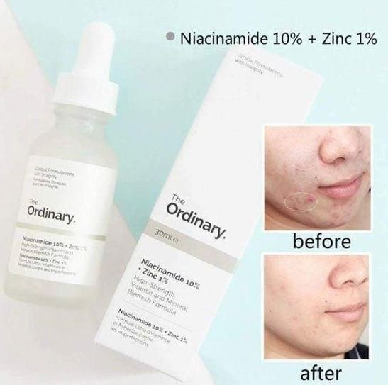 Ordinary Niacinamide